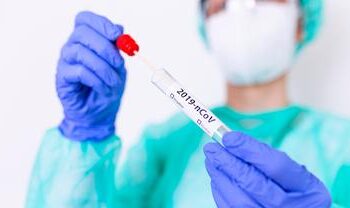 Dalam Seminggu Pasien Covid-19 di Tanjabbar Capai 183 Kasus dan 2 Meninggal Dunia