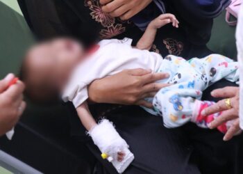 Kades Bunga Tanjung Sebut Bayi Zivana Telah Diberikan Gizi Tambahan